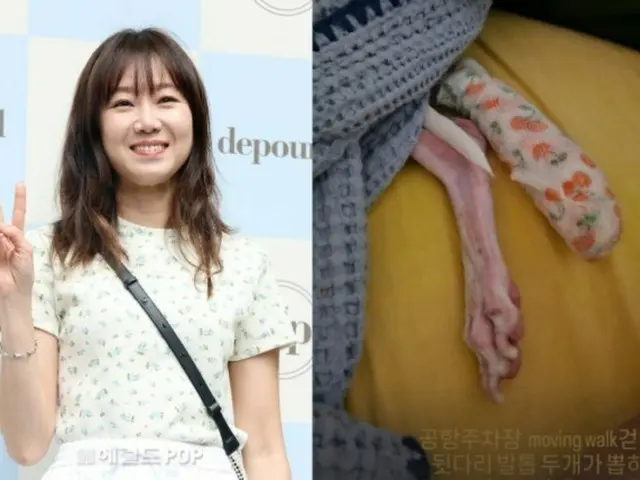 女優コン・ヒョジン、不注意で愛犬が事故に